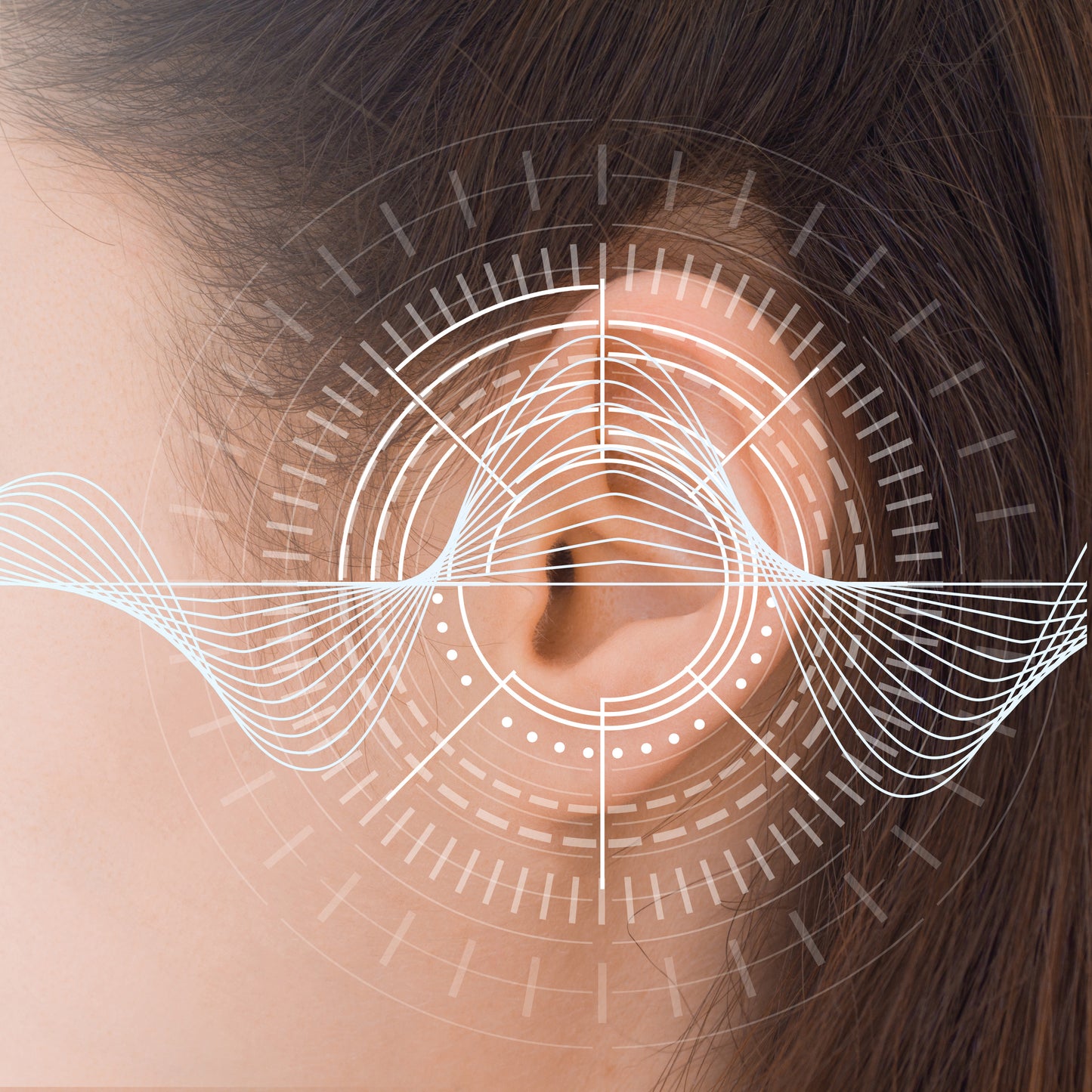 Can Tinnitus and Hearing Loss be Caused by EMFs, & Are There Safe Hearing Aids?