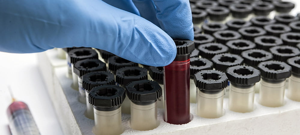 Photo of a gloved hand handling vials of blood
