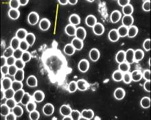 An image of the blood cells before using Blushield